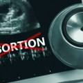 У овој земљи је забрањен абортус након шест недеља трудноће