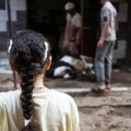 Krava otelila tele sa dve glave i osam nogu: Veterinari došli u selo i ostali zapanjeni prizorom