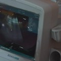 Preventivni pregledi nastavljeni u Velikim Pčelicama