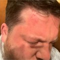 Napadnut blizak saradnik Navaljnog, objavljene fotografije! Krv svuda - "Suzavac u oči, pa ga olupao čekićem" (foto)
