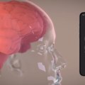 Neuralink planira test implantata za govor u oktobru