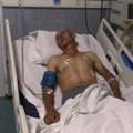 Zverski pretučenog Srbina prebacuju u Beograd: Teško povređeni Nenad iz Zubinog Potoka biće zbrinut u Urgentnom centru
