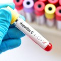 Američki gigant povlači ključni lek protiv hepatitisa C iz Rusije, a alternative nema