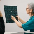Namirnice koje mogu biti povezane sa većim rizikom od demencije: Šta bi trebalo ograničiti u ishrani