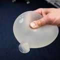 Implantati izvađeni iz grudi osvanuli u oglasima: Ruskinje ih prodaju, a zgroženi hirurzi upozoravaju na HIV