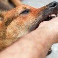 Nesrećna žena zadobila povrede po licu! Pas izleteo iz drvorišta, krenuo da kidiše na sve živo