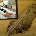 Mladić se 30 minuta borio sa krokodilom na život i smrt: Smrvio mi obe noge, izvukao sam ruku, ali odgrizao mi je prst…