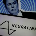 14 Miliona ljudi videlo je snimak koji je podelio i elon Musk: Neuralinkov pacijent igra šah "telepatski" na laptopu! (video)