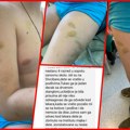 Drama na Divčibarama! Vršnjak pretukao dečaka motkom na rekreativnoj nastavi! Dok ga je mlatio dete kukalo: Oglasila se…