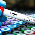HIV registrovan kod 1,3 miliona ljudi: Od side umrlo 630.000 osoba
