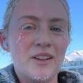 Trčala sam na -22°C i završila u hitnoj: Ono što sam preživela opametilo me je za sva vremena (video)