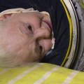 Preminuo poslednji pacijent u SAD sa 70 godina života u gvozdenim plućima