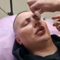 Bio najbolji frajer u rijalitiju, pa mu doktori unakazili lice: Izobličio se i naduo, pa nestao iz javnosti
