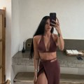 Kako je Jovana Đorđević izgledala pre operacija? Zbog nekih se gorko pokajala (FOTO)