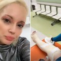 Maja Nikolić pokazala gips do kolena pred pze: "Otklizala sam s vrha parkinga, sama sam kriva"