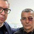 Predsednik Vučić posetio policajca povređenog ispred RTS-a: "Zadobio je teške telesne povrede"