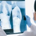 Preventivni pregledi povodom Dana astme: Bez uputa do spirometrije i saveta lekara
