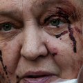 (Foto) Krvavih lica istrčavali iz zgrada! Scene razaranja iz Kijeva obilaze svet, broje se mrtvi u Ukrajini: "U šoku sam"