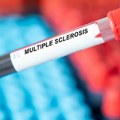 Светски дан мултипле склерозе – на сваких пет минута у свету неко добије дијагнозу МС