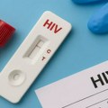 Besplatno i brzo HIV testiranje – dođite bez zakazivanja!