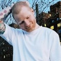 Ед Ширан открио да је морао да се ошиша због болести: "Сада се опорављам..." ФОТО