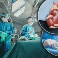 Možete biti donor organa čak i ako to ne potpišete, uvode se dva registra: Uskoro nova pravila o transplataciji, pacijenti…