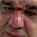 Saša Mirković se oglasio iz bolnice nakon incidenta u Zagrebu: Evo kakve povrede je zadobio