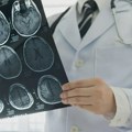 Pet ključnih oblasti koje veštačka inteligencija menja u zdravstvu… i tu neće biti kraj