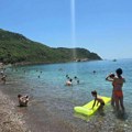 Drama na letovanju Ova morska neman urnisala dečaka na plaži: Njen ubod je jako bolan, a koža izgleda jezivo foto