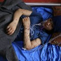 "Vratite mi moje noge": Potresne priče iz Gaze: Bolnice pune dece kojima su amputirani udovi, ona očajnički mole lekare