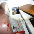 Krv kod otoka Krka: Dvoje ozlijeđenih u nesreći glisera