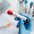 Zabrinjavajući podaci: U jednoj godini 2.200 novih infekcija virusom HIV