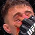 Usporeni snimak šokantnog kraja glavne borbe na UFC 321: Gan "prodžarao" prstima Aspinalu oba oka