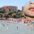 Na hrvatskim plažama pojavila se zaraza „slatke kraste“: Doktorka kaže da se lako širi