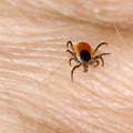 Šta uraditi kada se krpelj zakači za kožu? Pospite ga ovim sastojkom i sam će otpasti za 20 minuta