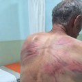 Petković: "Kurtijevi policajci koji su zverski pretukli Raškovića vraćeni su na posao posle mesec dana" FOTO
