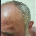 Policiji dobacio da "hapse kriminalce": Pretukli ga pred detetom, pa pretili Centrom za socijalni rad