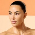 Porodica zabrinuta, Kim Kardašijan u stahu: Lekar tvrdi da je aneurizma na mozgu pred pucanjem