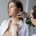 Besplatni pregledi kože: Otkrivena 32 melanoma, stručnjaci apeluju na redovnu kontrolu