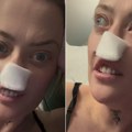 "Osećala sam kako mi se celo lice podiže i kako me udara čekićem": Otišla u Tursku da sredi zube, a sada prolazi kroz noćnu…