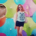Srpska pevačica završila na ulici, 5 dana nije jela: Pokazala užasne povrede, potresna ispovest sve šokirala (foto)
