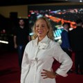 Lepa Brena sopstvenu krv ubrizgala u lice da bi izgledala mlađe: „Volim sve da probam“