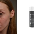 Da li preparati za sužavanje pora zaista deluju? Istražujemo korejski beauty trend koji osvaja svet