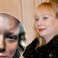 "Nisam znala šta je sve smrskano i izvaljeno iz moje glave": Glumica se prisetila jezive nesreće koju je doživela: "Skupila…