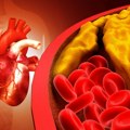 "Čišćenje" arterija hranom? Ove namirnice drastično smanjuju rizik od infarkta i opasnih naslaga u telu