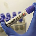 Batut se hitno oglasio zbog hantavirusa: Otkriveno da li smrtonosni virus cirkuliše u Srbiji