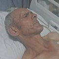 Srbin iz Drena nakon što ga je kosovska policija pretukla: „Upali su u u kuću i maltretirali mi ženu i sina“