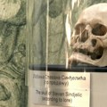 Lobanja za koju se veruje da pripada vojvodi Stevanu Sinđeliću na skeniranju u Nišu