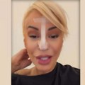 "Pao mi je vrh nosa!" Dušica Jakovljević skroz oblepila nos flasterima, šokirala izdanjem i javno se oglasila: Otkrila metodu…