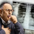 Novi, čudni simptomi muče građane, ali i lekare: Haraju silni respiratorni i stomačni virusi, nema ko već nije bolestan, a…